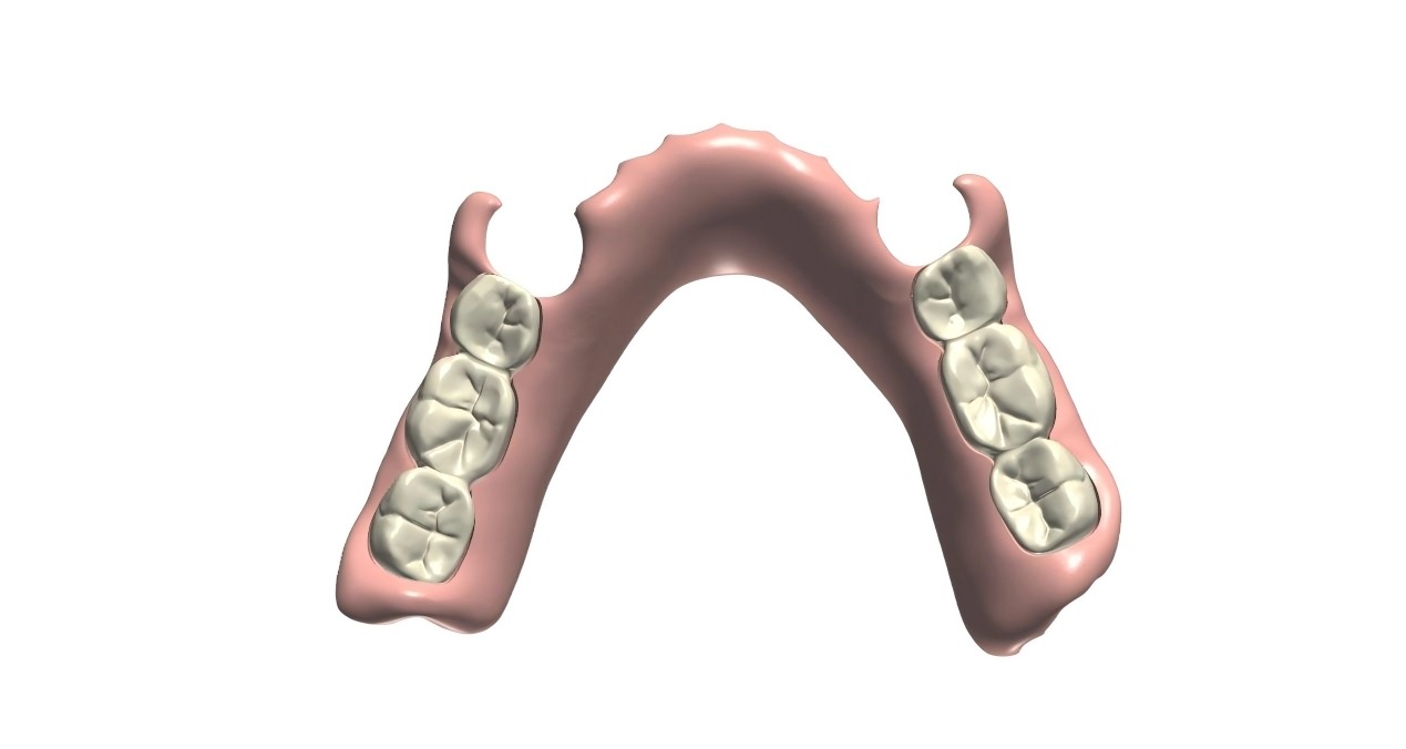 Digital dental design model